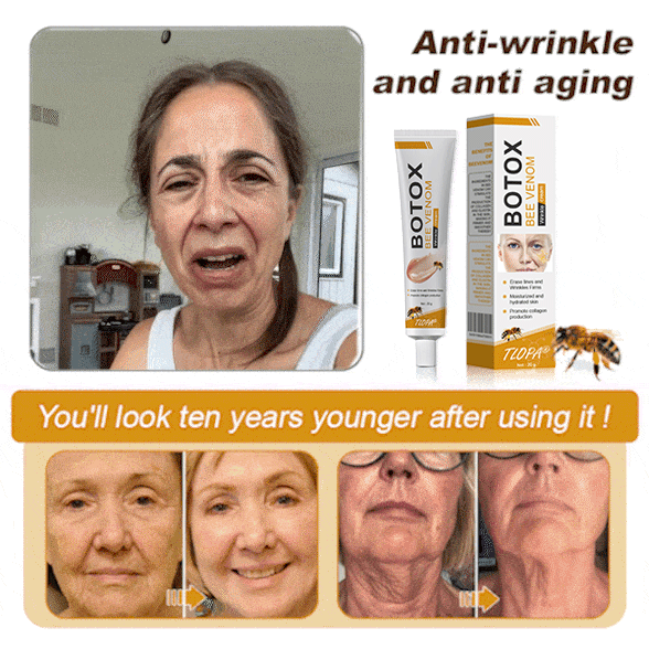 The (VIRAL) Bee Venom Wrinkle Cream