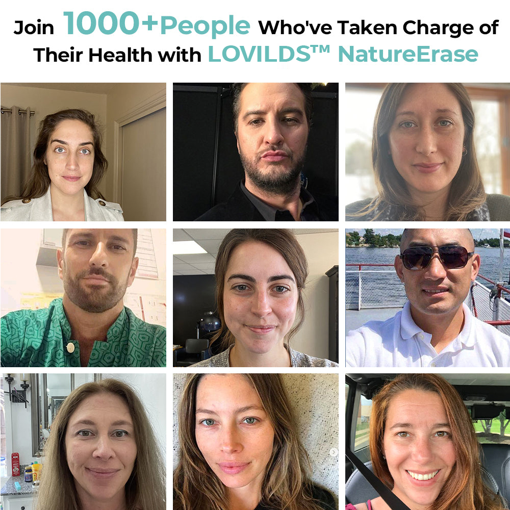 ✅ Official Store: LOVILDS™ NatureErase Instant Alligator Oil Mole & Spot Removal Gel