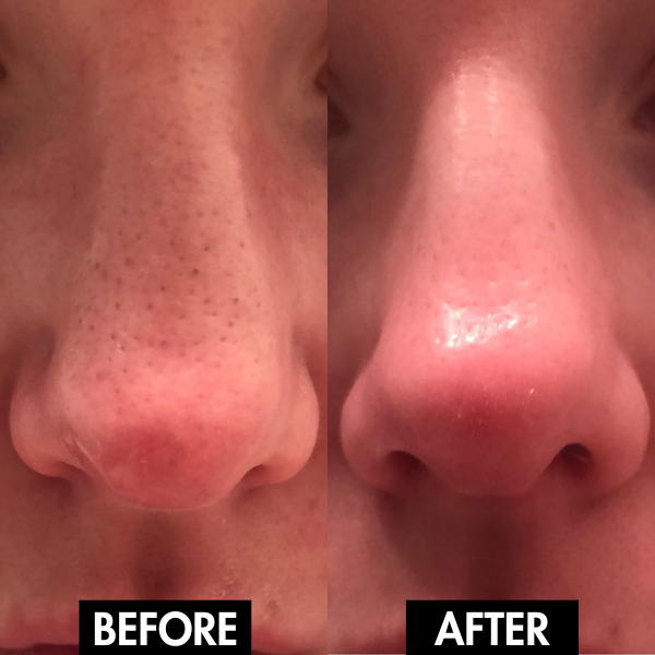 Lunaris™ Facial Purity Device