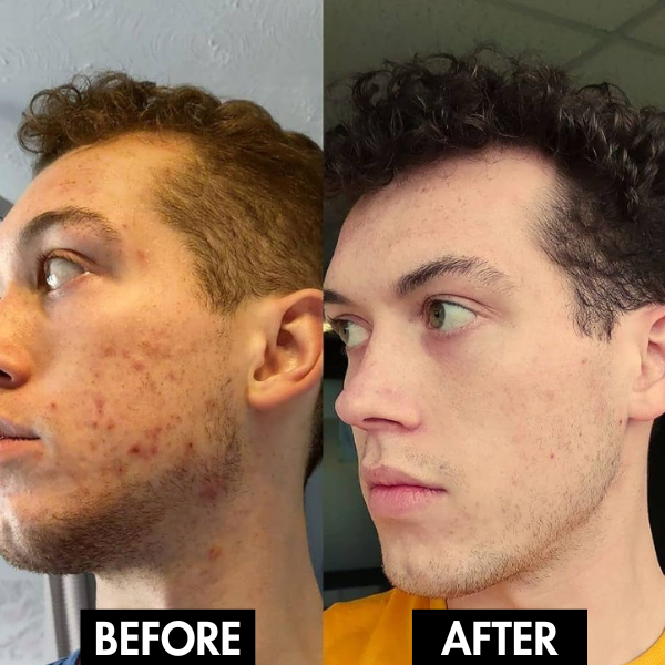 Lunaris™ Facial Purity Device